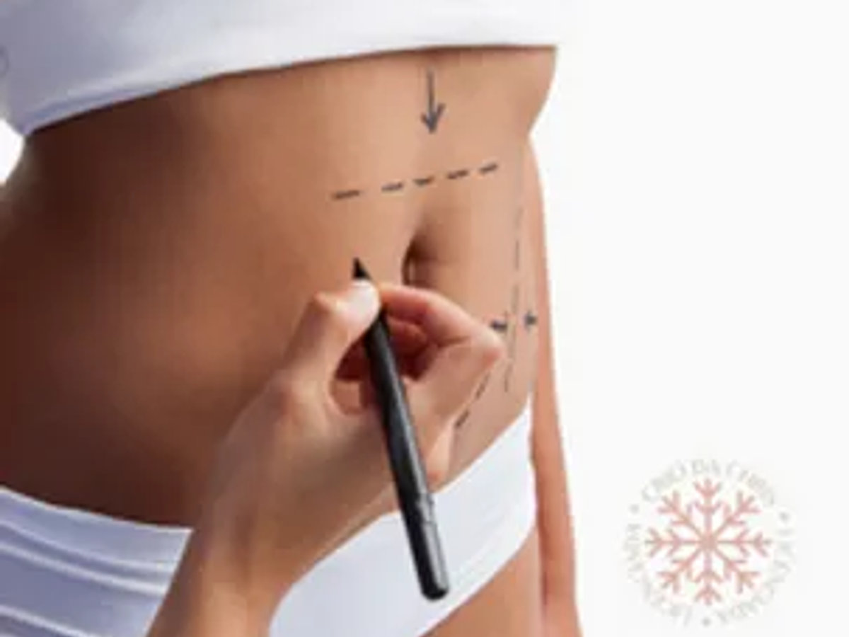Procedimento corporal